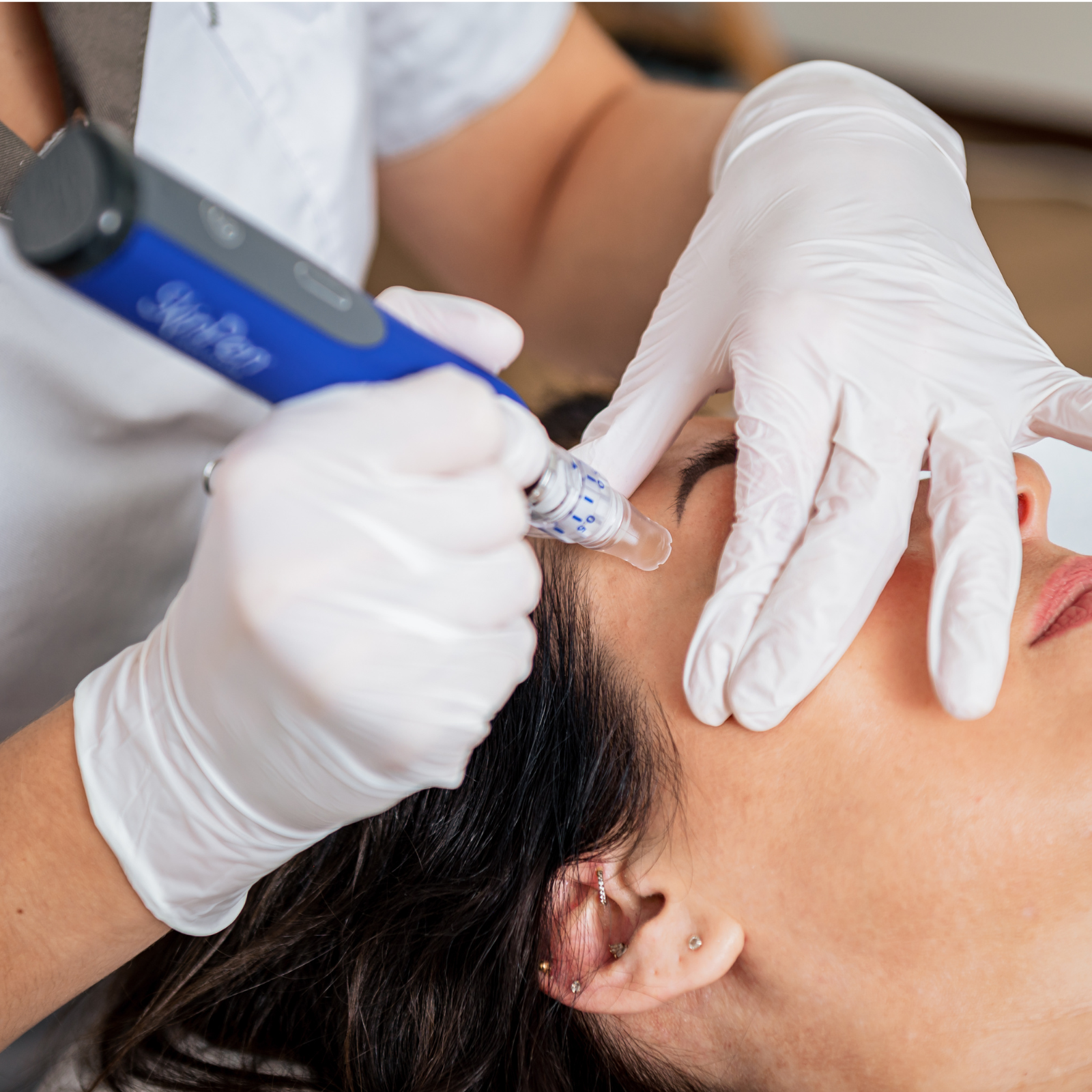 Medische microneedling
